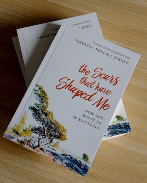 Astonished by God Books - 00000013 The Scars That Have Shaped Me